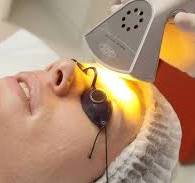 Plástica Biofotônica Facial
